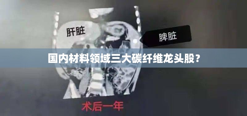 国内材料领域三大碳纤维龙头股？